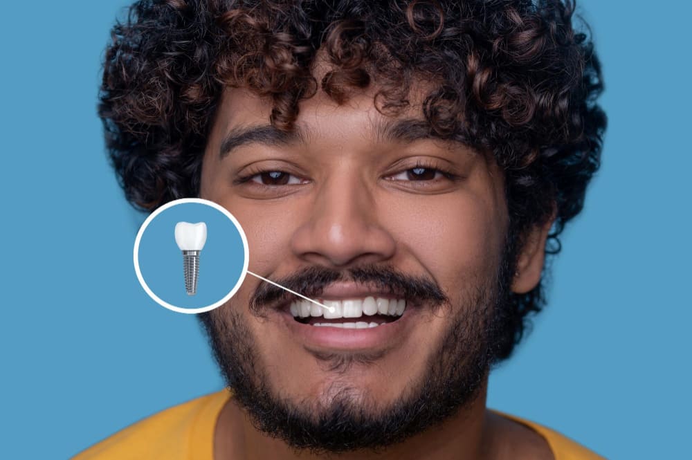 Maintaining Your New Dental Prosthetics