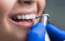 Porcelain Veneers Sydney